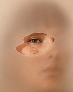 Top 7 Kem Trị Mụn Ẩn