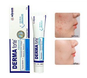 Top 7 Kem Trị Mụn Ẩn