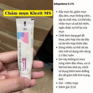 Top 7 Kem Trị Mụn Ẩn